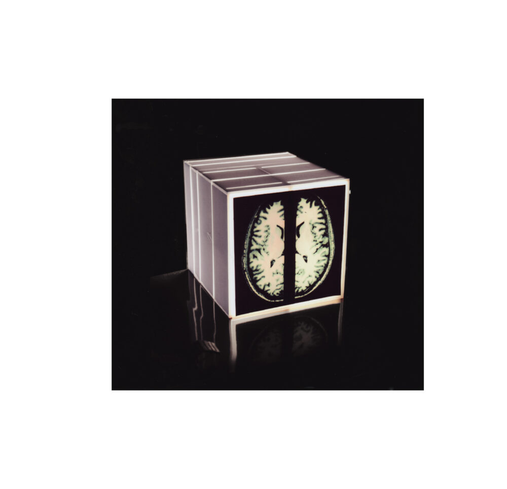 Three sides of a cube that emits light are shown before a black background with an image of a brain scan on one of the sides.